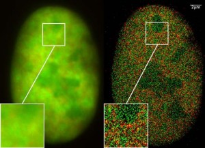 Nucleus of a bone cancer cell with traditional microscopy (left) and super-resolution microscopy (right). Histones are red (RFP-H2A) and chromatin remodeling proteins are green (GFP-Snf2H). Two color localization microscopy reveals single molecule density in a wide field of view using conventional fluorescent proteins.