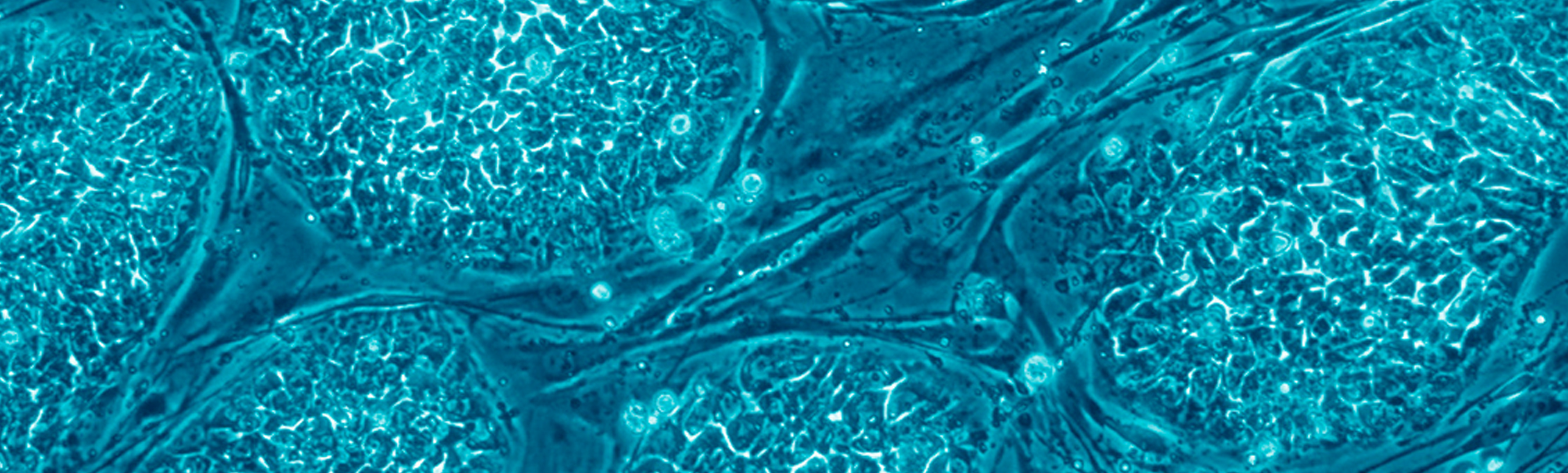 Embryonic stem cells grow as round colonies on top of a layer of long fibroblast supporting cells.
